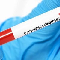 blood test for cancer screening