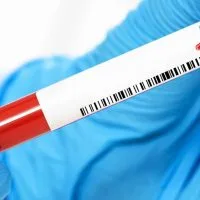 blood test for cancer screening