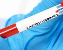 blood test for cancer screening