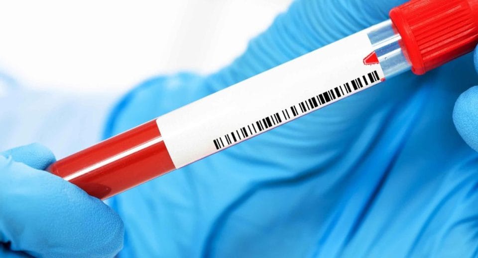 blood test for cancer screening
