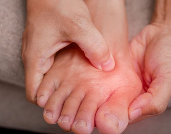 bunion surgery singapore cost​