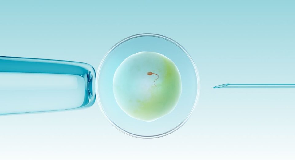 Ivf procedure