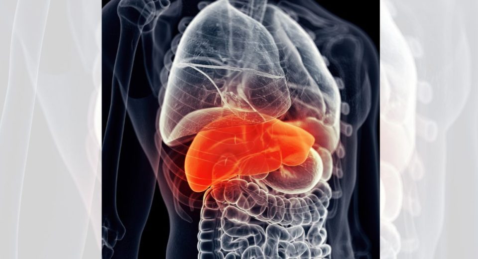 fatty liver