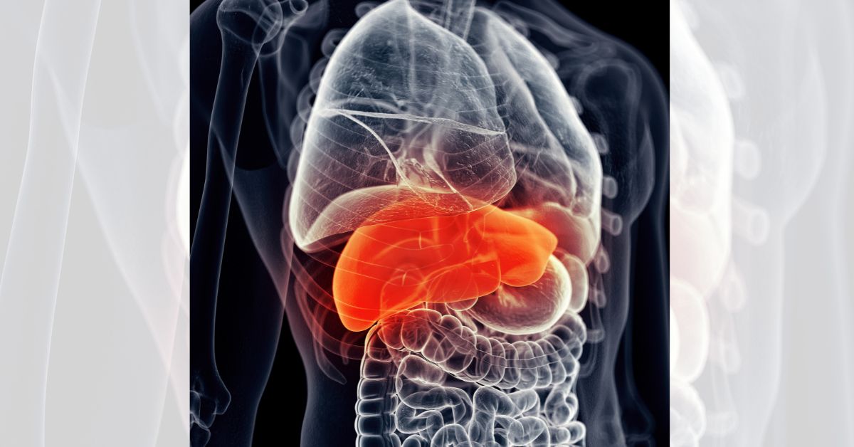 fatty liver