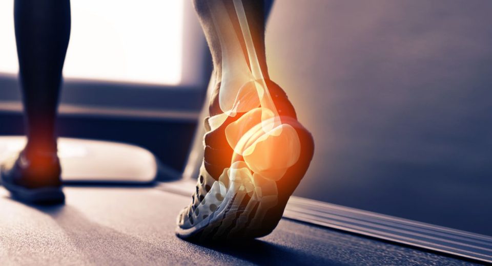 heel sports injury​