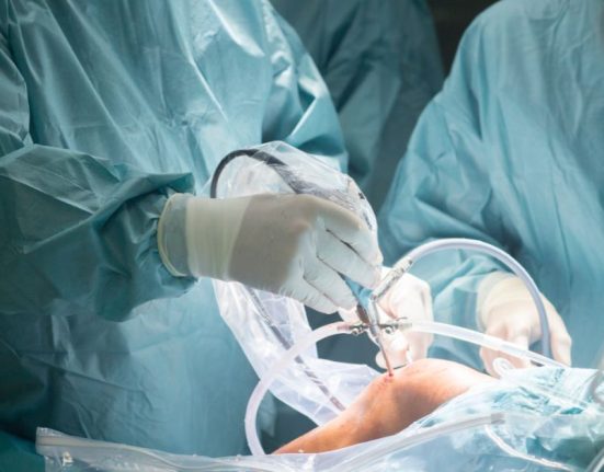 minimally invasive surgery