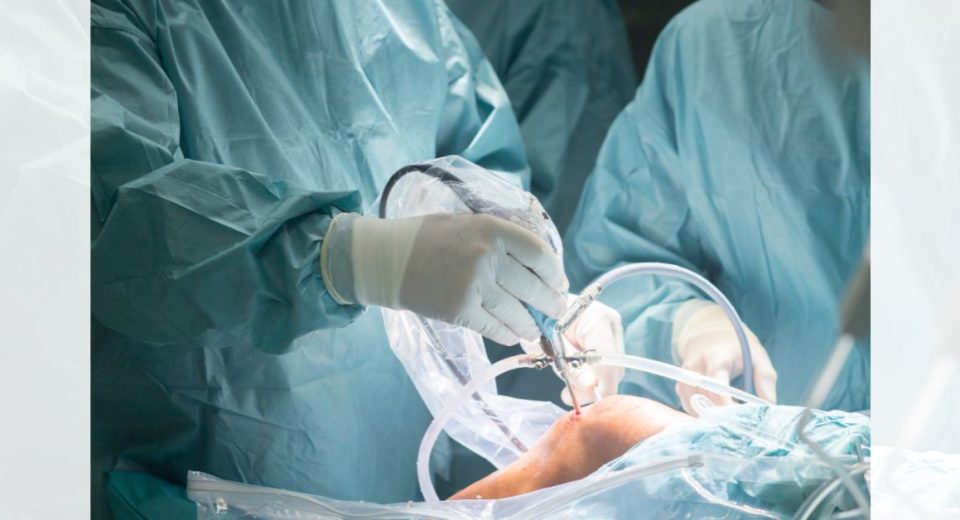 minimally invasive surgery