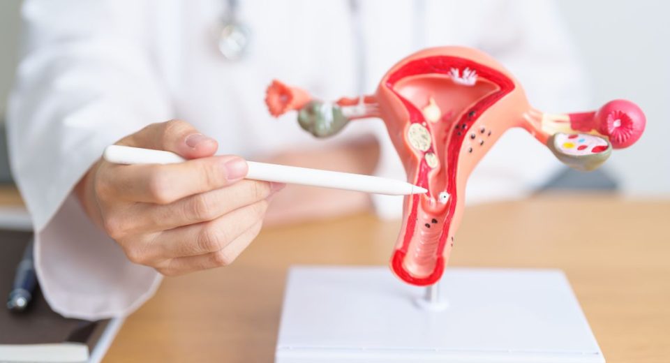 ovarian cancer screening singapore