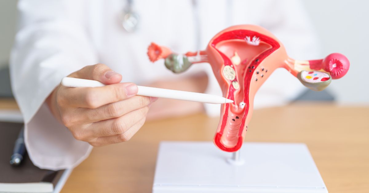 ovarian cancer screening singapore