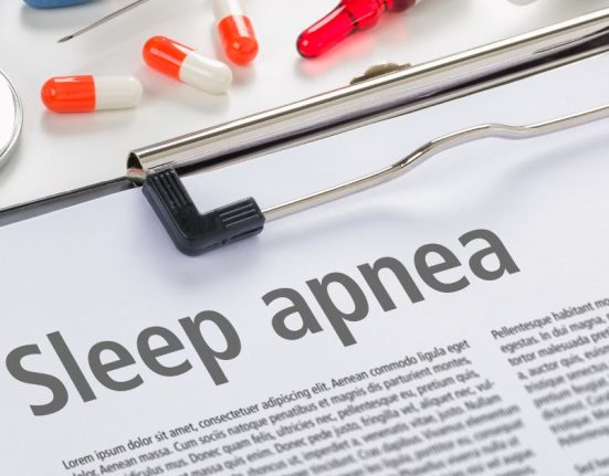 sleep apnea singapore