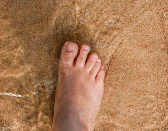 swollen feet