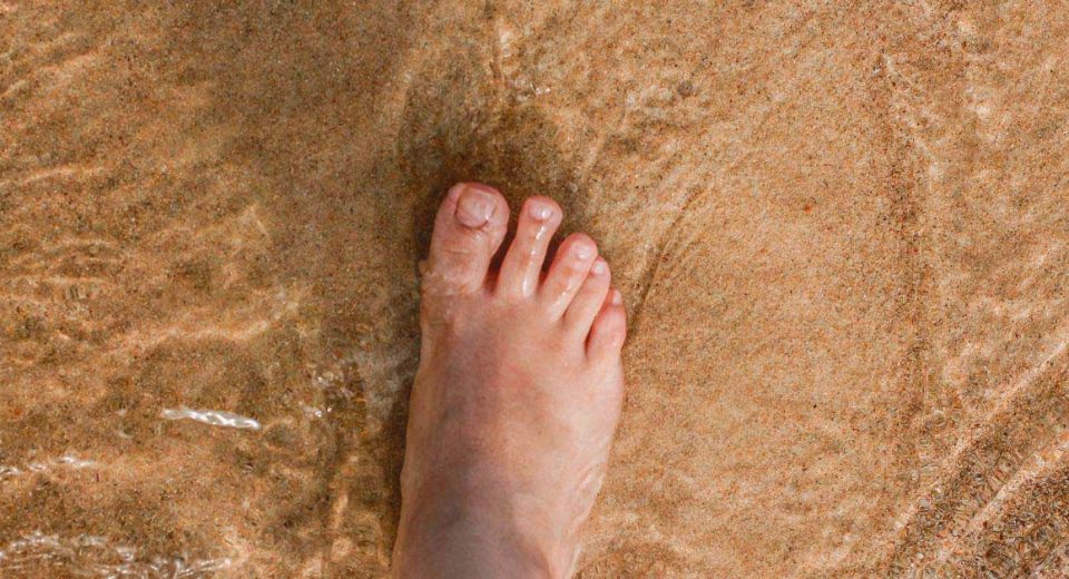 swollen feet