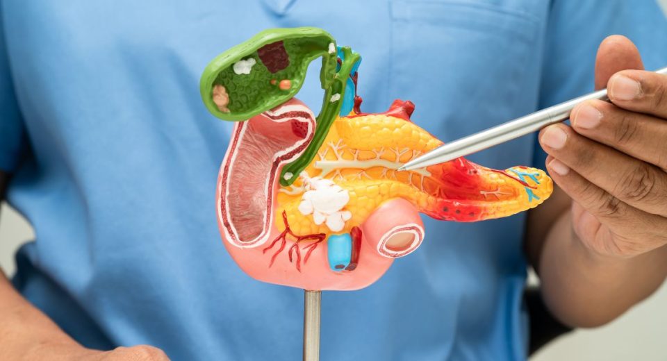 Types of Pancreatic Cancer