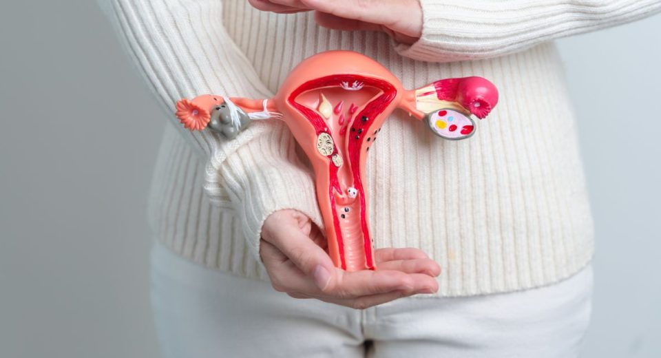 can i have endometriosis without pain​
