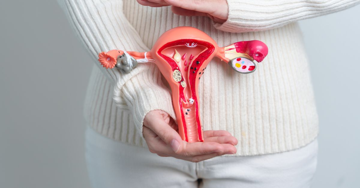 can i have endometriosis without pain​