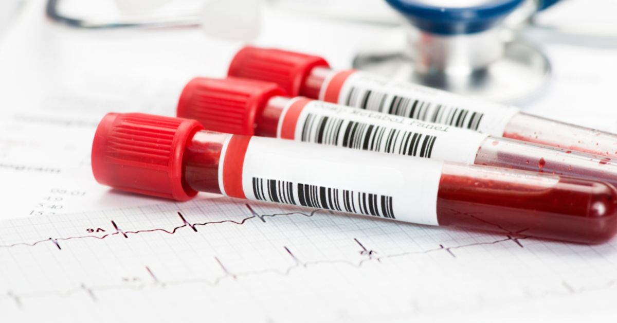 Cancer Marker Test Singapore: Guide To Early Cancer Detection