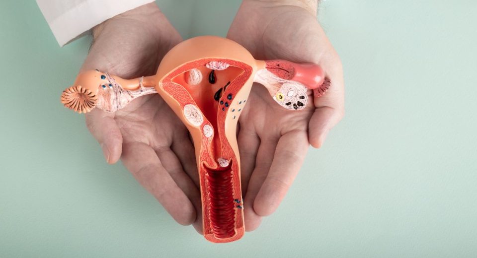 endometriosis surgery