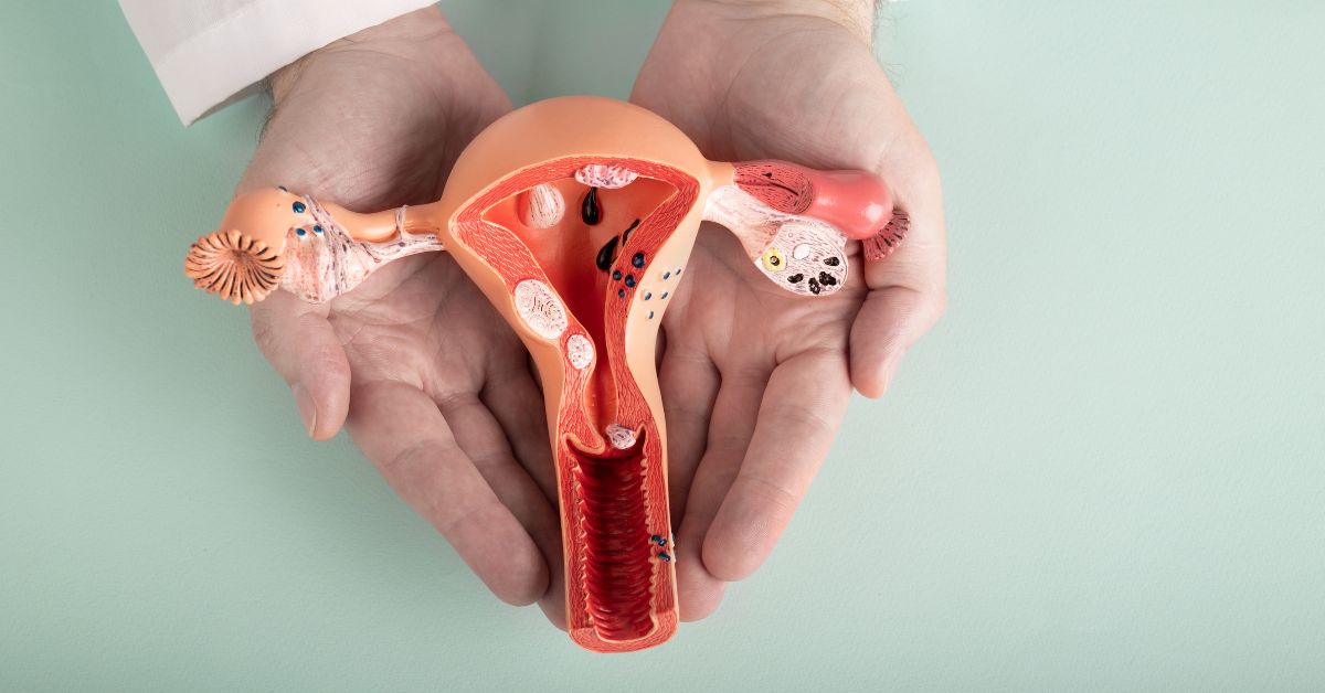 endometriosis surgery
