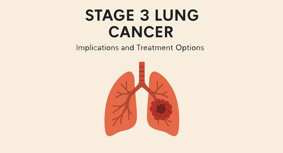 stage 3 lung cancer