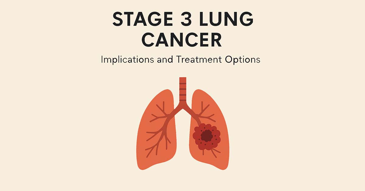 stage 3 lung cancer