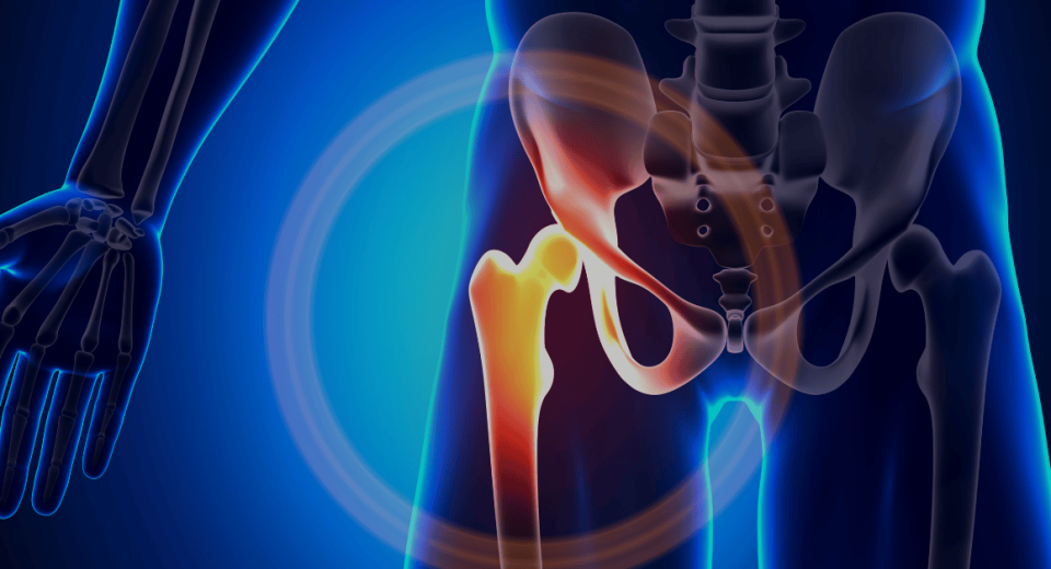 Thinking About Hip Replacement Surgery in Singapore?