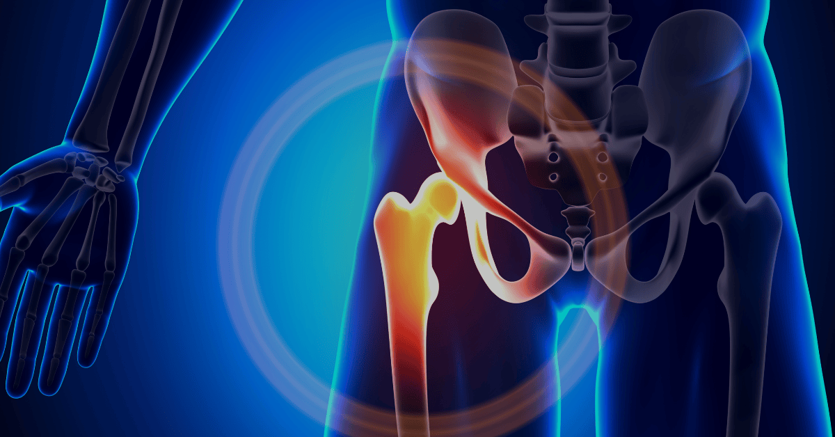 Thinking About Hip Replacement Surgery in Singapore?