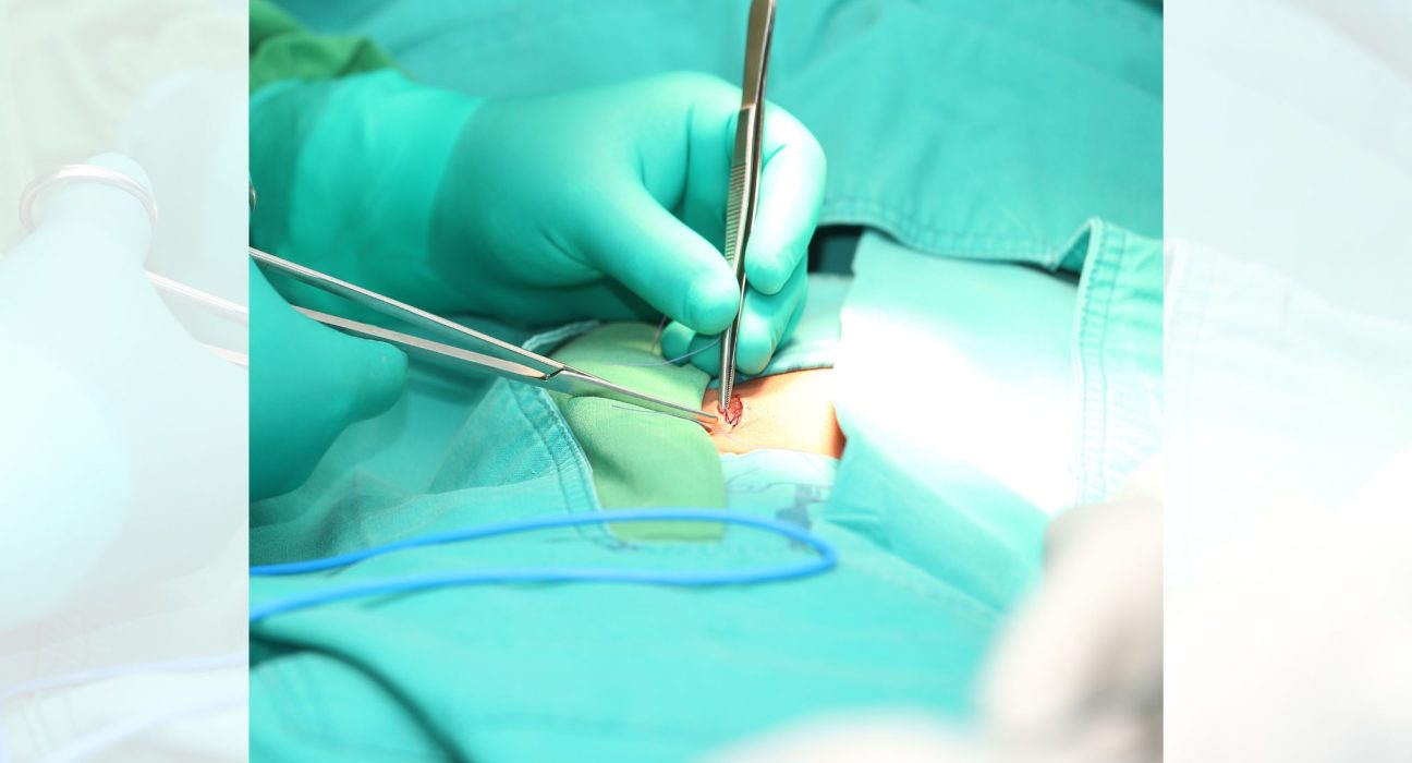 Hernia Repair