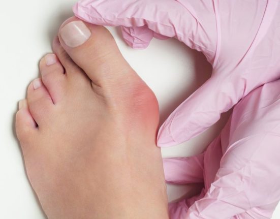 bunion surgery singapore price