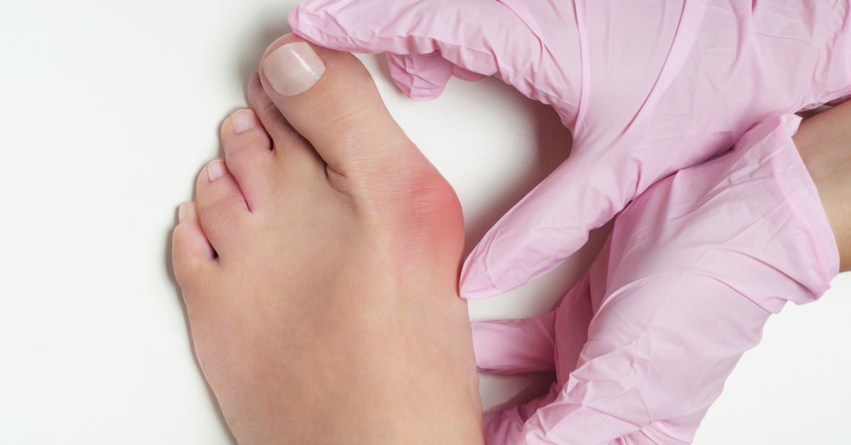 bunion surgery singapore price
