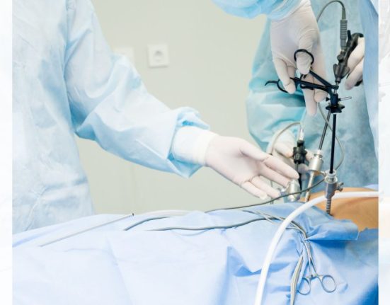 laparoscopic left inguinal hernia repair