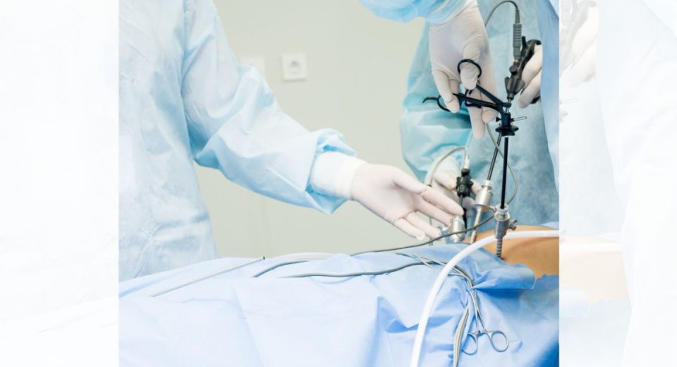 laparoscopic left inguinal hernia repair