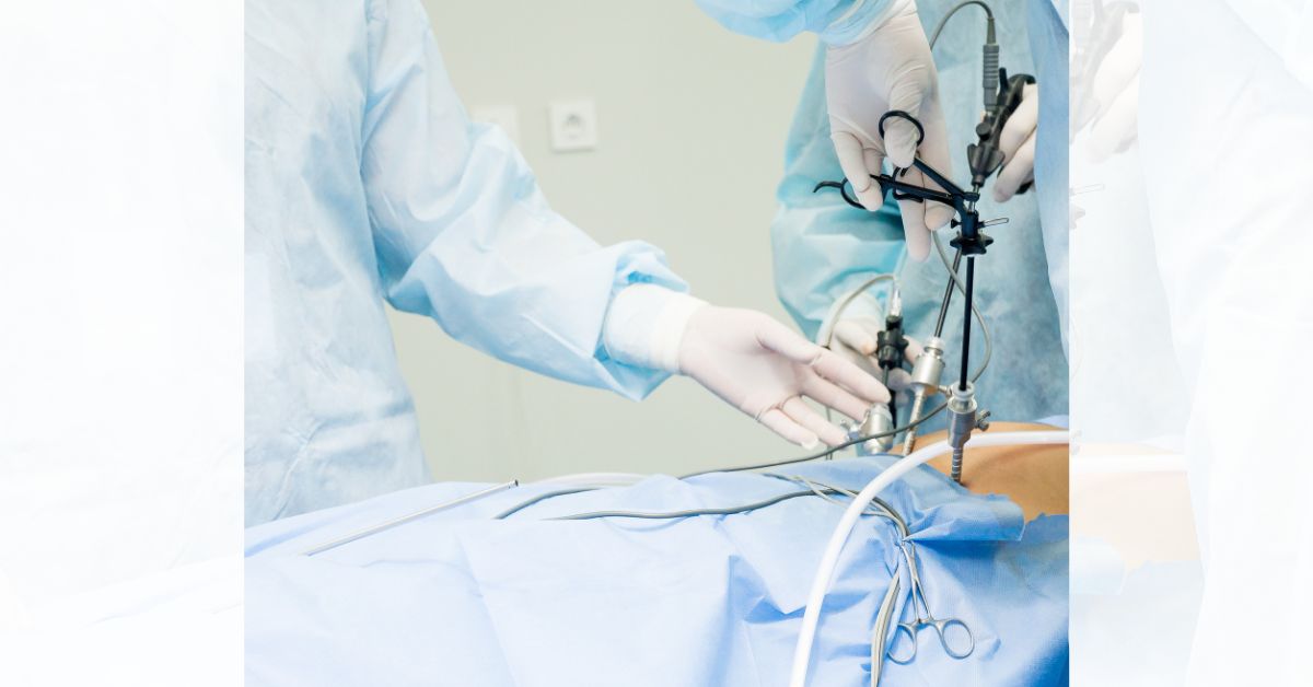 laparoscopic left inguinal hernia repair