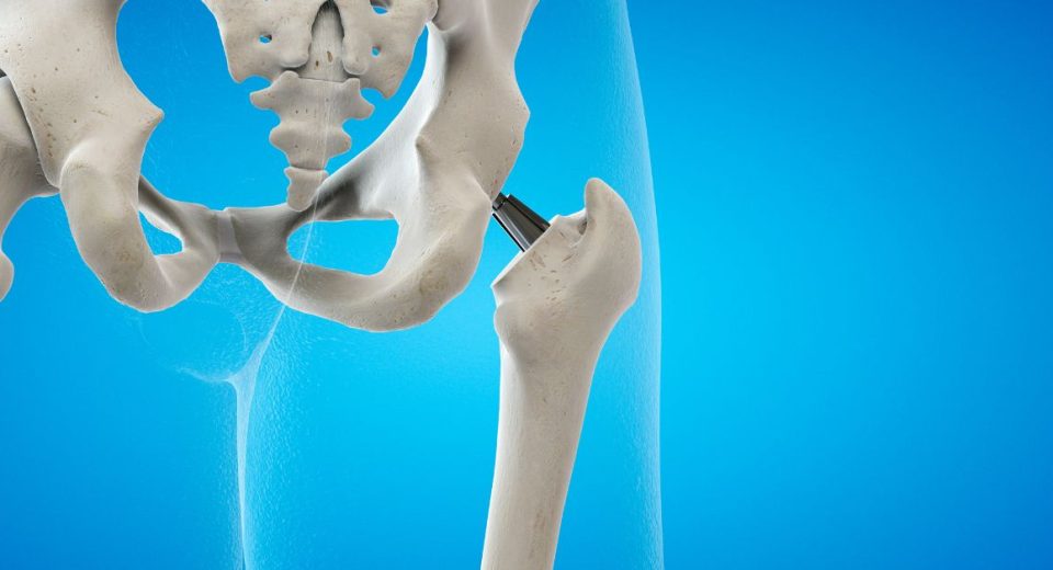 orthopaedic surgery