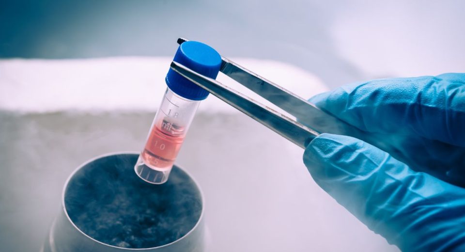 stem cell therapy singapore