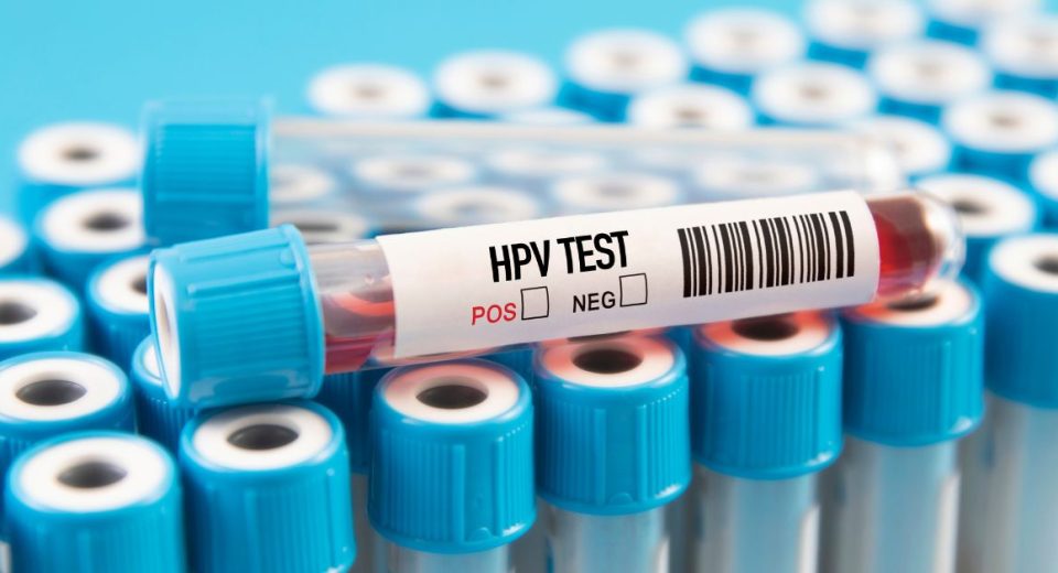what is hpv test
