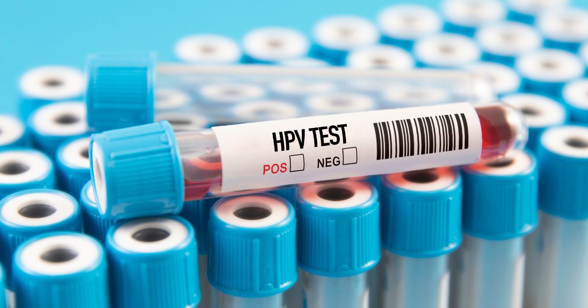 what is hpv test