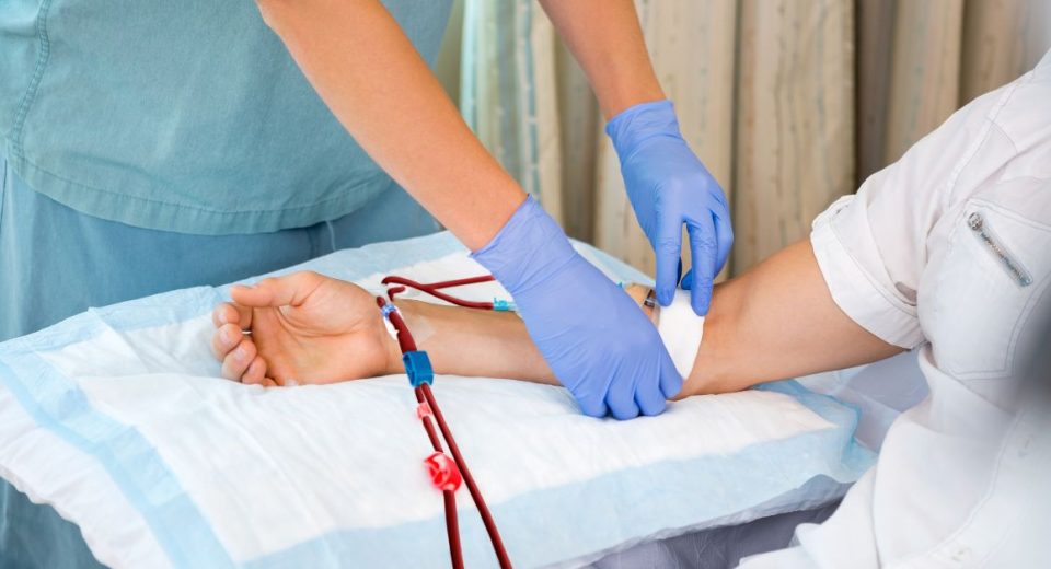 AV Fistula for Dialysis Patients