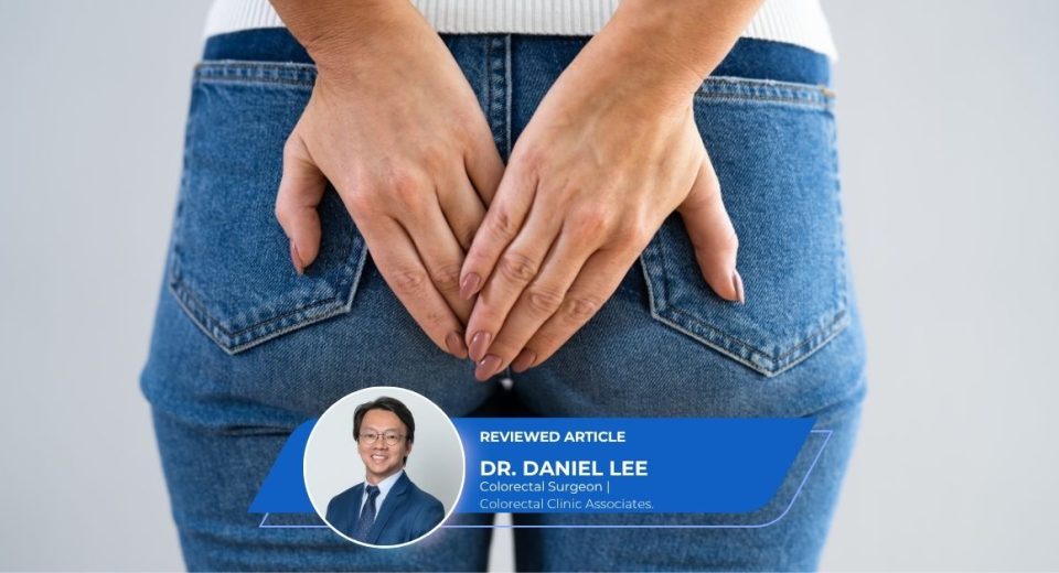 Anal Fistula Surgery