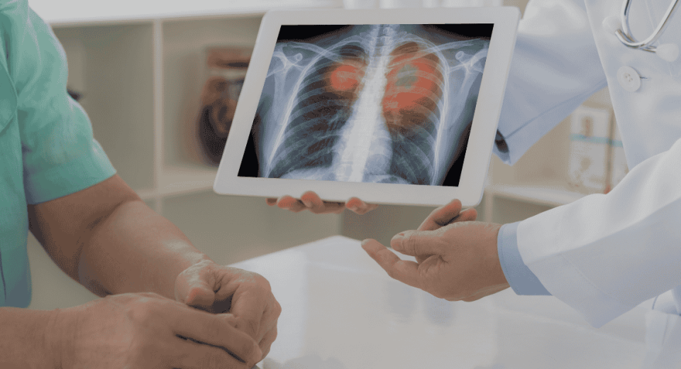 How to Lower Your Risk of Lung Cancer in Singapore: Prevention Tips That Work