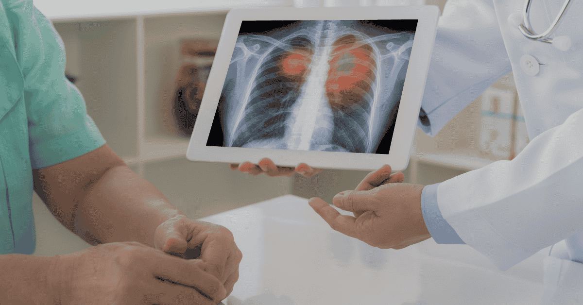 How to Lower Your Risk of Lung Cancer in Singapore: Prevention Tips That Work