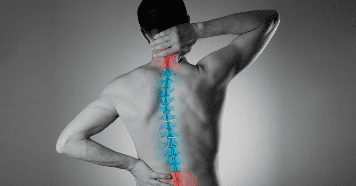 Scoliosis in Singapore: Types, Symptoms, and Treatment Options