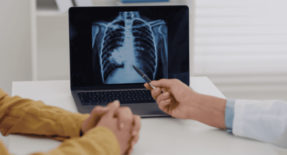 How Family History Affects Your Risk of Lung Cancer