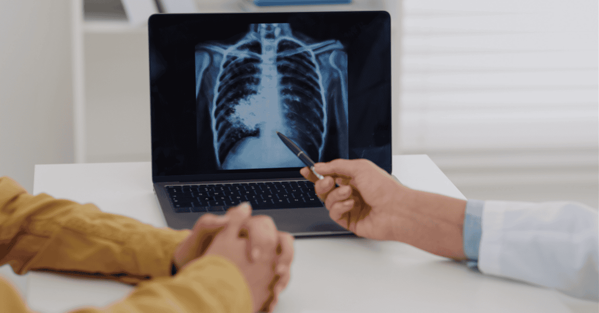 How Family History Affects Your Risk of Lung Cancer