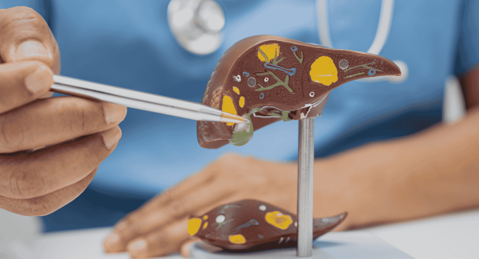 Hepatitis B & Liver Cancer in Singapore: Why Screening Matters