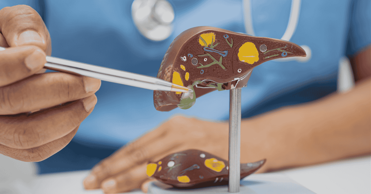 Hepatitis B & Liver Cancer in Singapore: Why Screening Matters