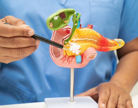 Gallstone removal surgery