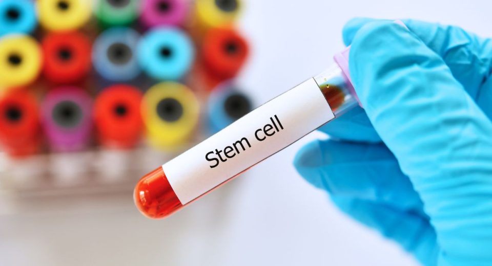 stem cell singapore