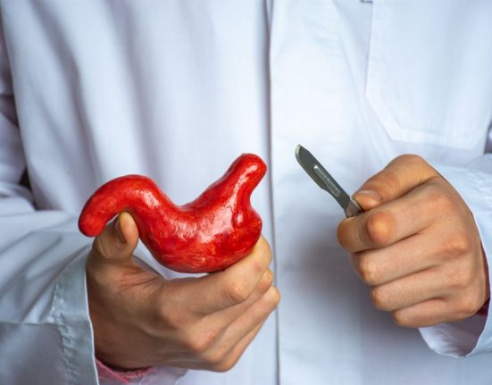 Bariatric Surgery Singapore