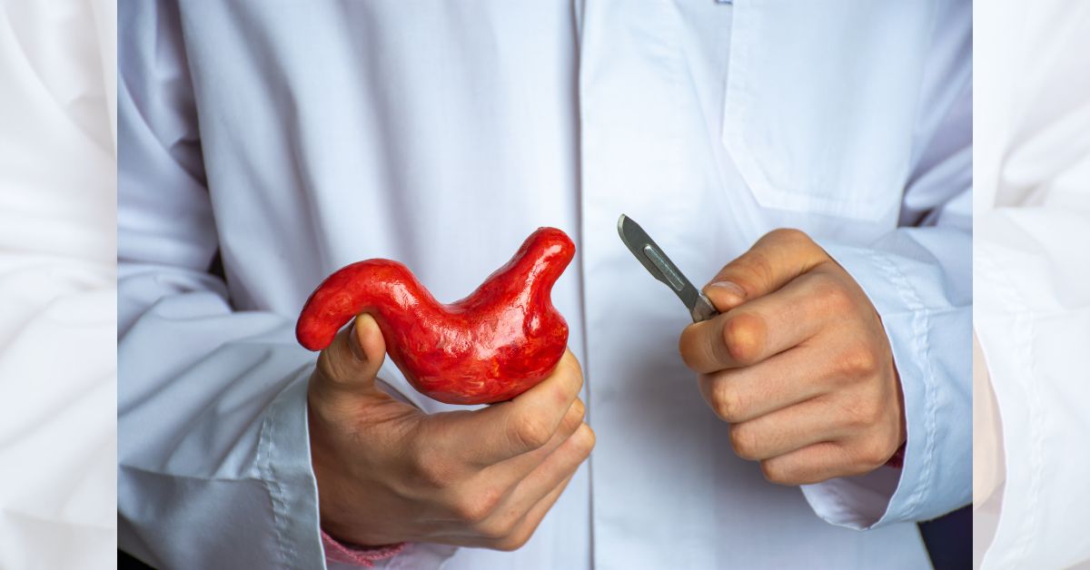 Bariatric Surgery Singapore