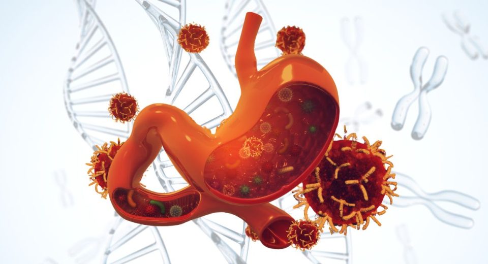 DNA and Stomach Cancer Risk